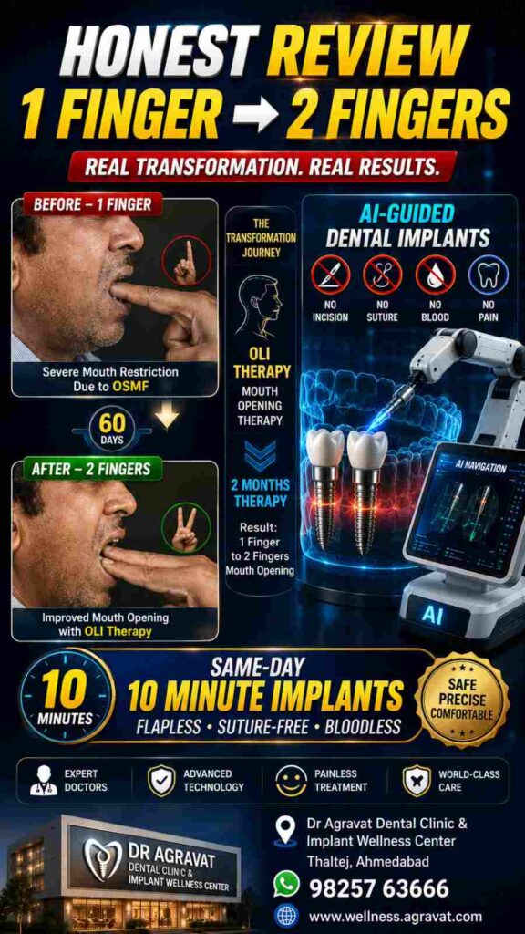 Honest Review 1 FINGER 2 FINGERS OSMF Mouth Opening Program OLI Therapy Same day Dental Implant Ahmedabad Gujarat Indi-100kb