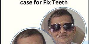 Mouth Opening OLI Therapy Dental Implants Review