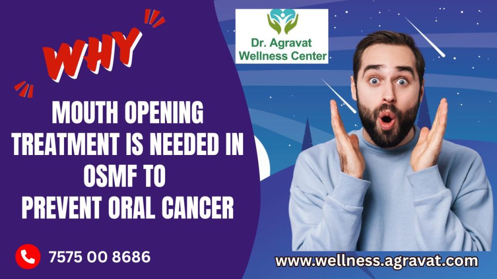 Why OSMF Mouth Opening Treatment needed to Prevent Oral Cancer At Dr Agravat Wellness Center, Ahmedabad, Gujarat, Maharashtra, India