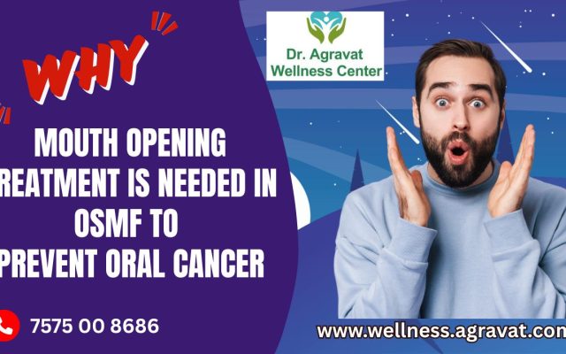 Why OSMF Mouth Opening Treatment needed to Prevent Oral Cancer At Dr Agravat Wellness Center, Ahmedabad, Gujarat, Maharashtra, India