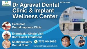 Dr Agravat Dental Clinic and Implant Wellness Center Ahmedabad, Gujarat, India