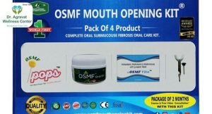 OSMF Mouth Opening Treatment Cost, Procedure, Benefits at Dr Agravat Dental Clinic Implants Wellness Center in Ahmedabad, Gujarat, India