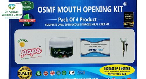 OSMF Mouth Opening Treatment Cost, Procedure, Benefits at Dr Agravat Dental Clinic Implants Wellness Center in Ahmedabad, Gujarat, India