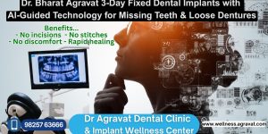 Fixed Teeth in 3 Days by Dental Implants