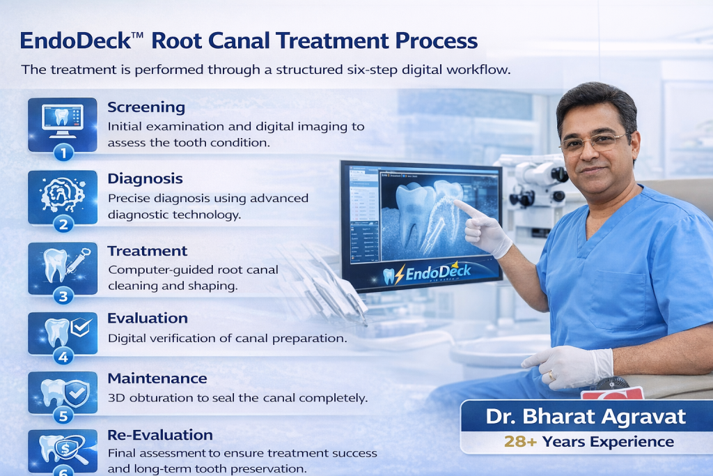 EndoDeck™ Root Canal Treatment Process by dr agravat ahmedabad