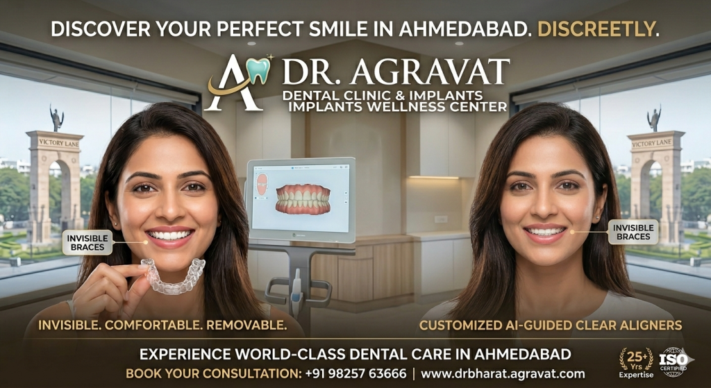Invisible Braces in Ahmedabad, Clear Aligners Cost India at Dr Agravat Dental Clinic and Implant Wellness Center sindhubhavan road