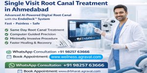Single Visit Root Canal Treatment in Ahmedabad Dr Agravat Wellness Center Sindhubhavan Road, Thaltej