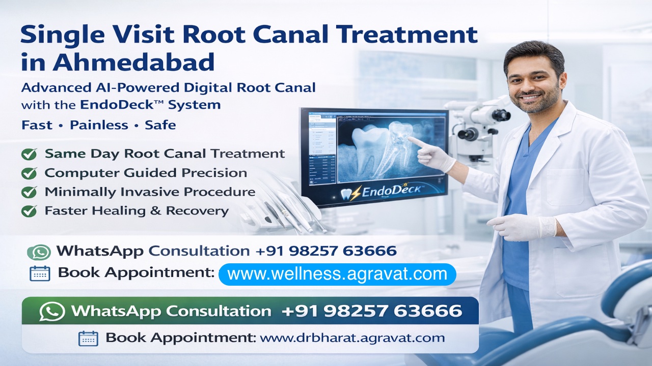 Single Visit Root Canal Treatment in Ahmedabad Dr Agravat Wellness Center Sindhubhavan Road, Thaltej
