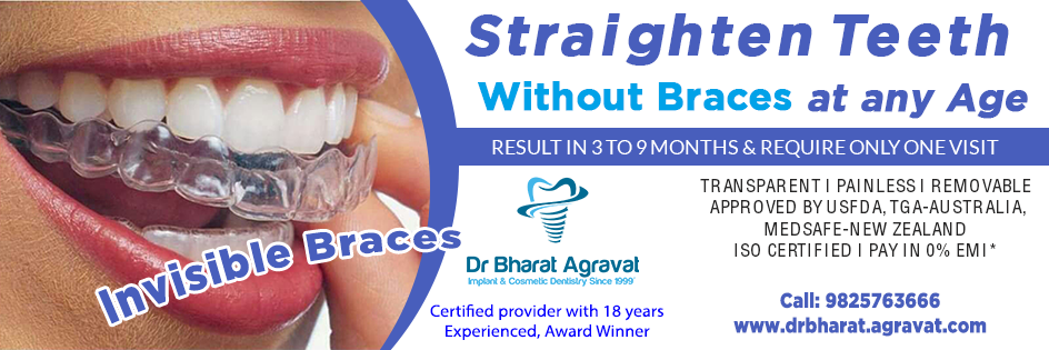 invisible-clear-braces-for-teeth-cost-price-reviews-in-ahmedabad-gujarat-India
